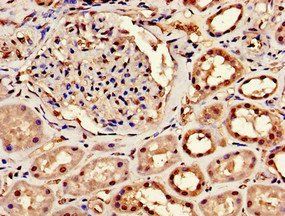 CPSF6 Antibody