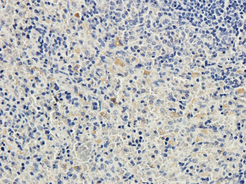 Cpt1a antibody