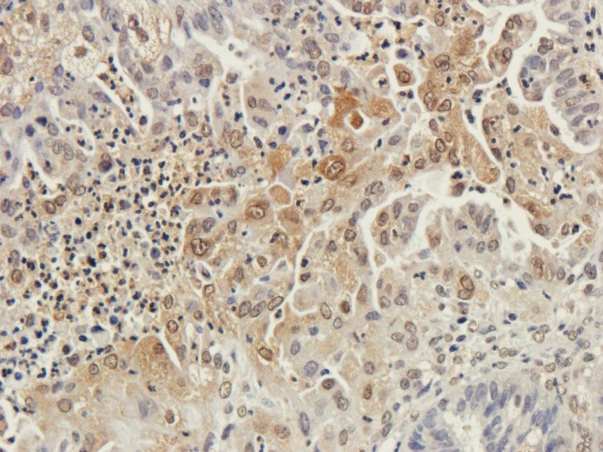 Cpt1a antibody