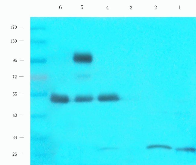 Cpt1a antibody