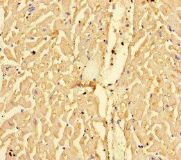 CPT1A Antibody