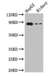 CPT1A Antibody