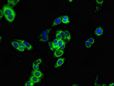 CPT1B Antibody