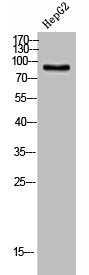 CPT1B Antibody