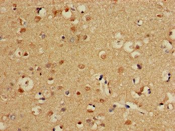 CPT1C Antibody