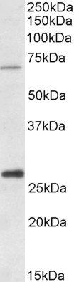 Goat anti-CPT2 (aa141-154) Antibody