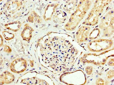 CPT2 Antibody