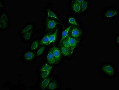 CPTP Antibody
