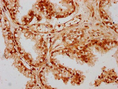 CPTP Antibody