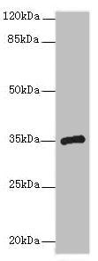 CPXCR1 antibody