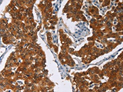 CRABP2 Antibody