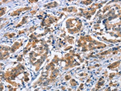 CRABP2 Antibody