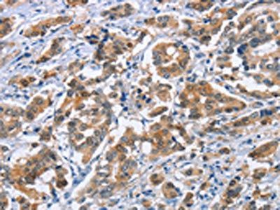 CRABP2 antibody