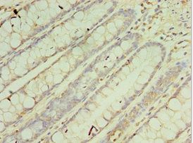 CRADD Antibody