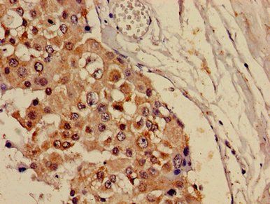 CRAT Antibody