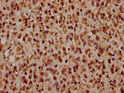 CRB2 Antibody