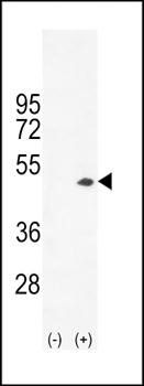 Creatine Kinase BB antibody