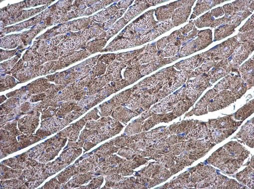 Creatine kinase (brain) antibody [N3C3]