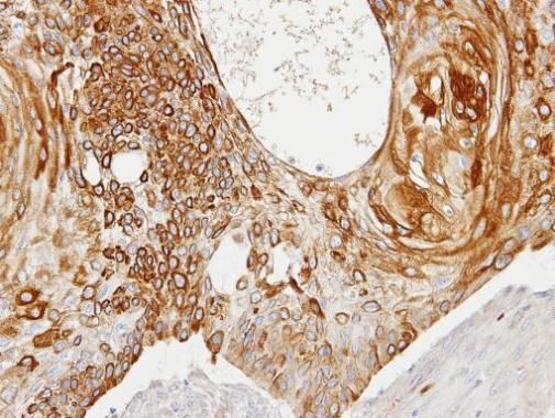 Creatine kinase (brain) antibody [N3C3]