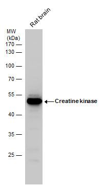 Creatine kinase (brain) antibody
