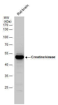 Creatine kinase (brain) antibody [N3C3]
