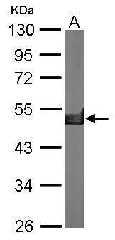 Creatine kinase (brain) antibody