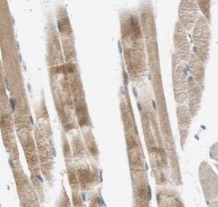 Creatine Kinase MM-Specific antibody