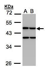 Creatine kinase MT antibody