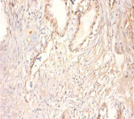 CKMT1A Antibody