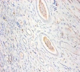 CKMT1A Antibody