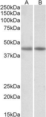Creatine kinase M-type antibody