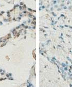 CREB1 Rabbit Polyclonal Antibody