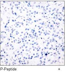 CREB (Phospho-Ser133) Antibody