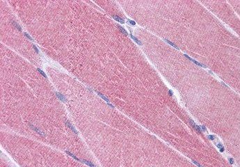 Goat anti-OASIS / CREB3L1 Antibody