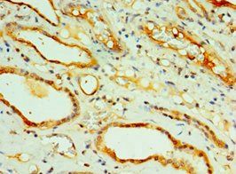 CREB3L2 Antibody