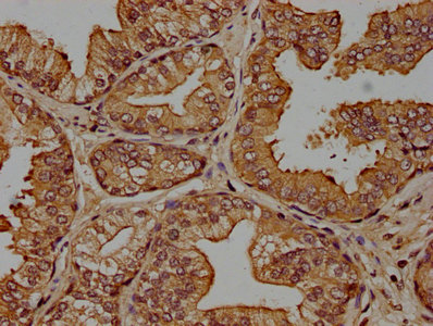 CRH Antibody