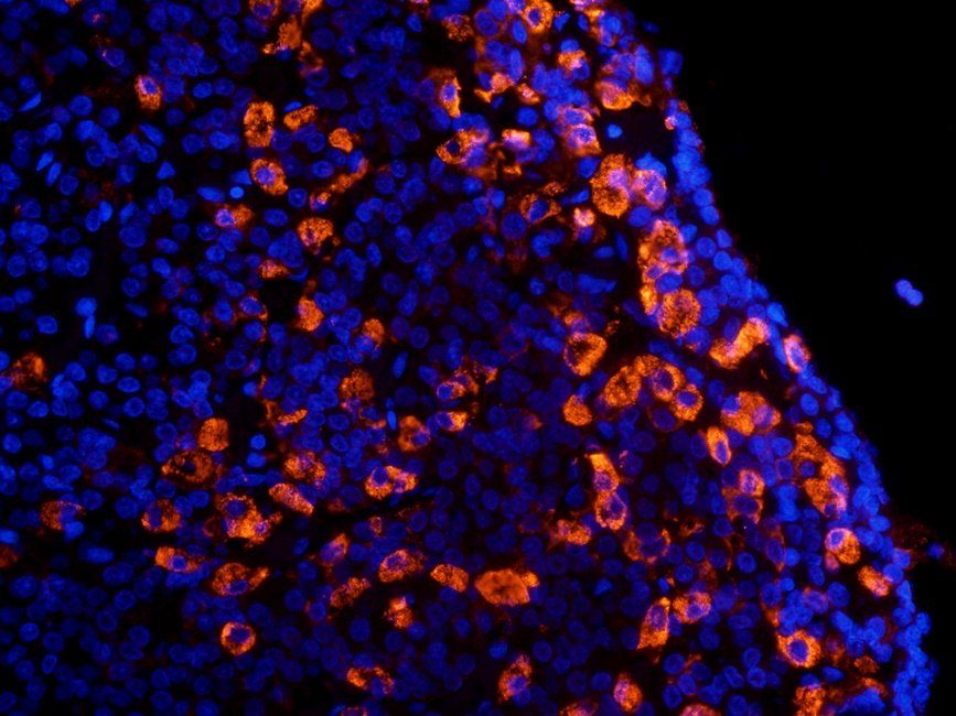 CRHR2 antibody