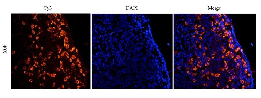 CRHR2 antibody