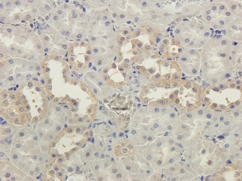 CRHR2 antibody