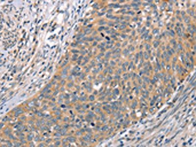 CRHR2 Antibody