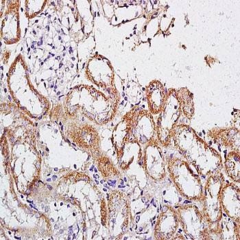CRHR2 Rabbit Polyclonal Antibody