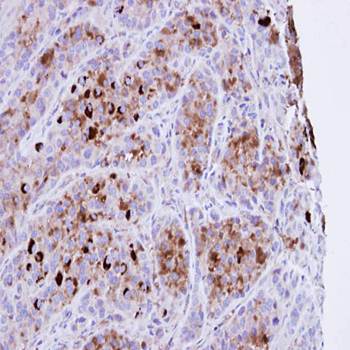 CRHSP-24 Rabbit Polyclonal Antibody