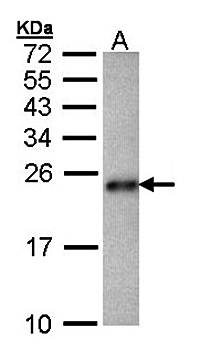 CRHSP-24 Rabbit Polyclonal Antibody
