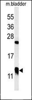 CRIP1 antibody