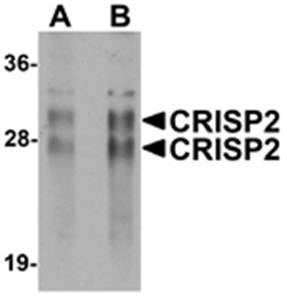 CRISP2 Rabbit Polyclonal Antibody