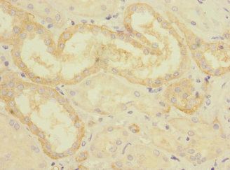 CRLF2 Antibody