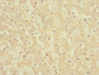 CRLF2 Antibody