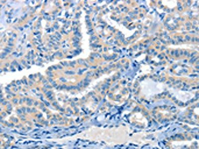 CRLF2 Antibody