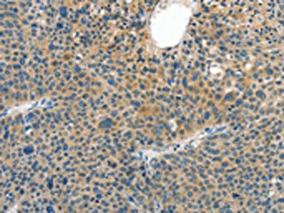 CRLF2 antibody