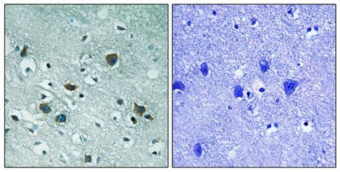 CRMP-2 (phospho-Thr509) antibody